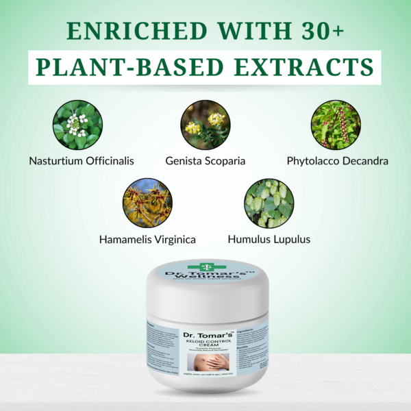 Keloid Control Cream