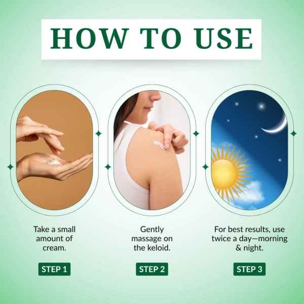 Keloid Control Cream