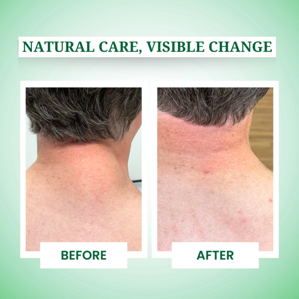 Lipo Clear Herbal Drops