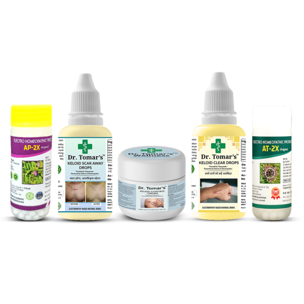 Keloid Treatment Plan