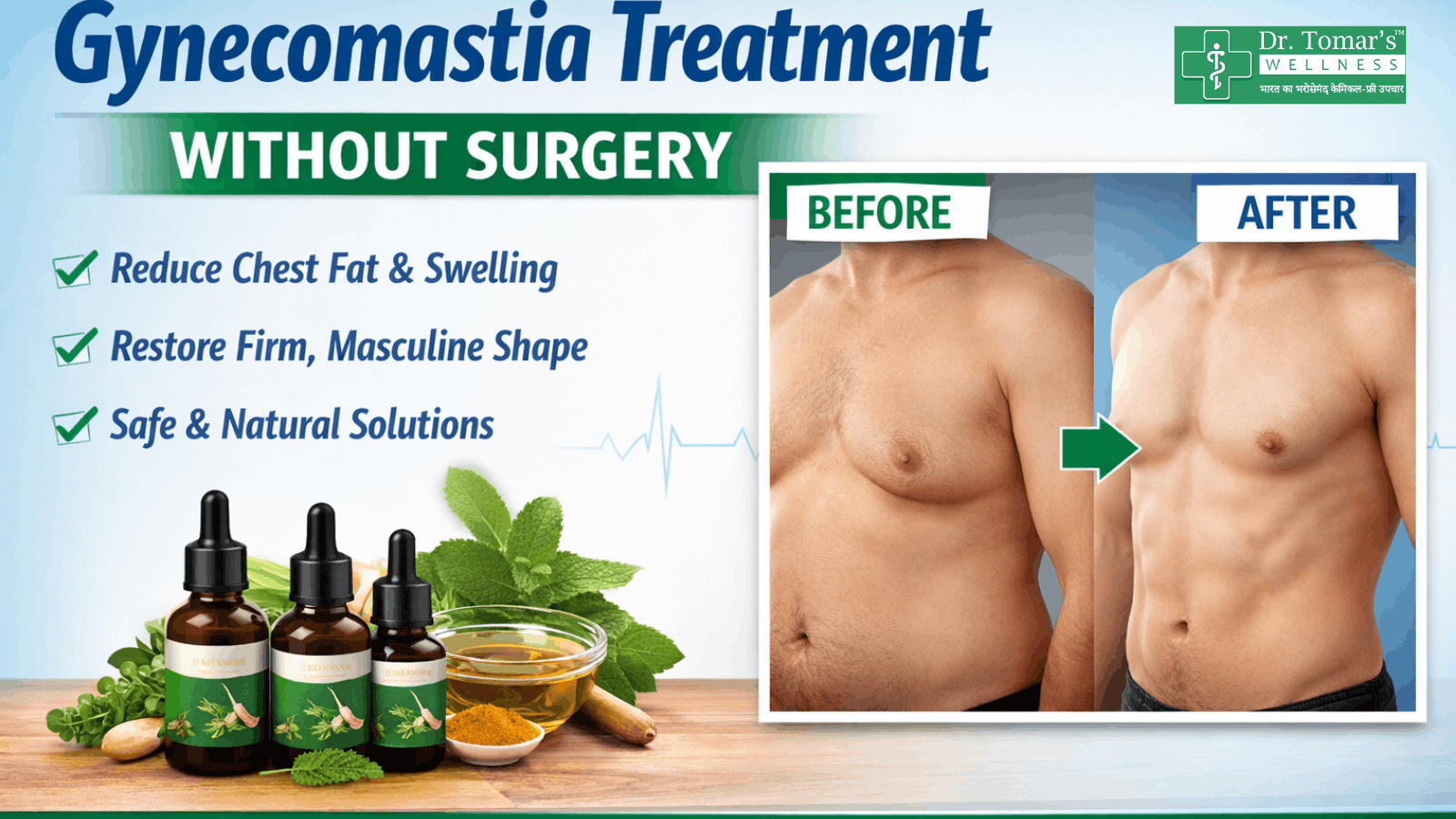 Gynecomastia Treatment Without Surgery