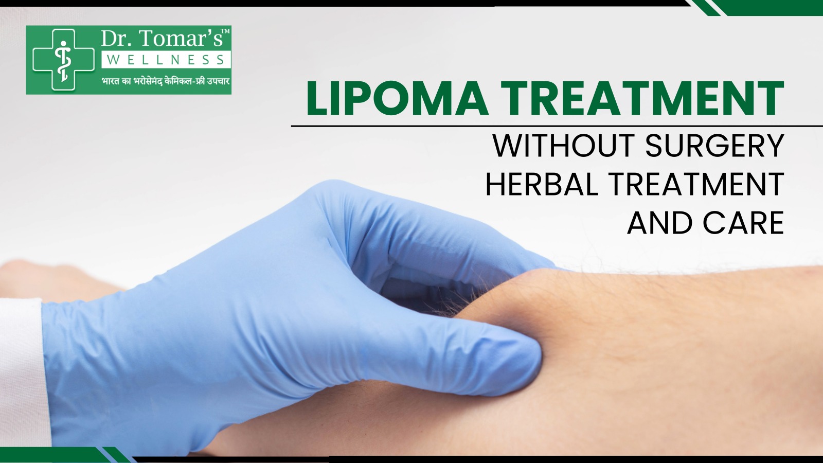 Lipoma treatment without surgery