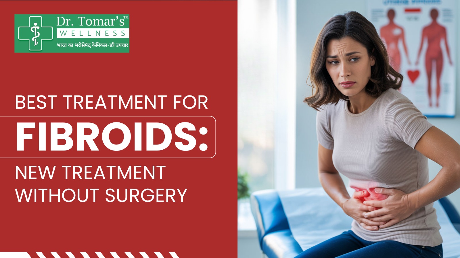 best treatment for fibroids