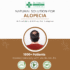 Natural Solution For Alopecia E-Book