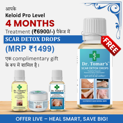 Best non-surgical treatment for keloid scars -Dr Tomars 4 month plan