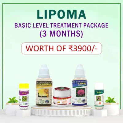 natural lipoma treatment