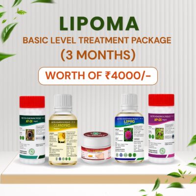 lipoma treatment plan advance