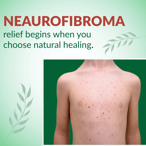 neurofibroma
