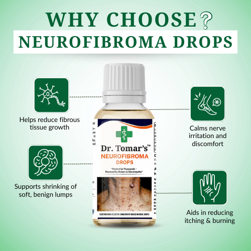 neurofibroma