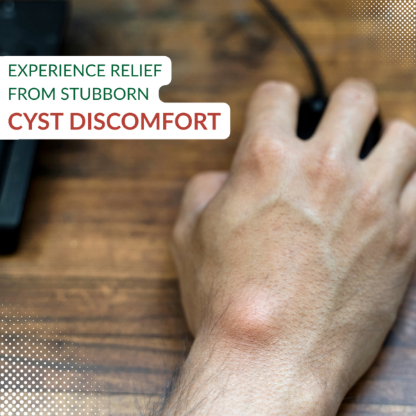 Cyst Relief drops