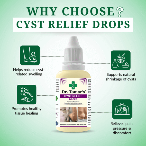 Cyst Relief drops