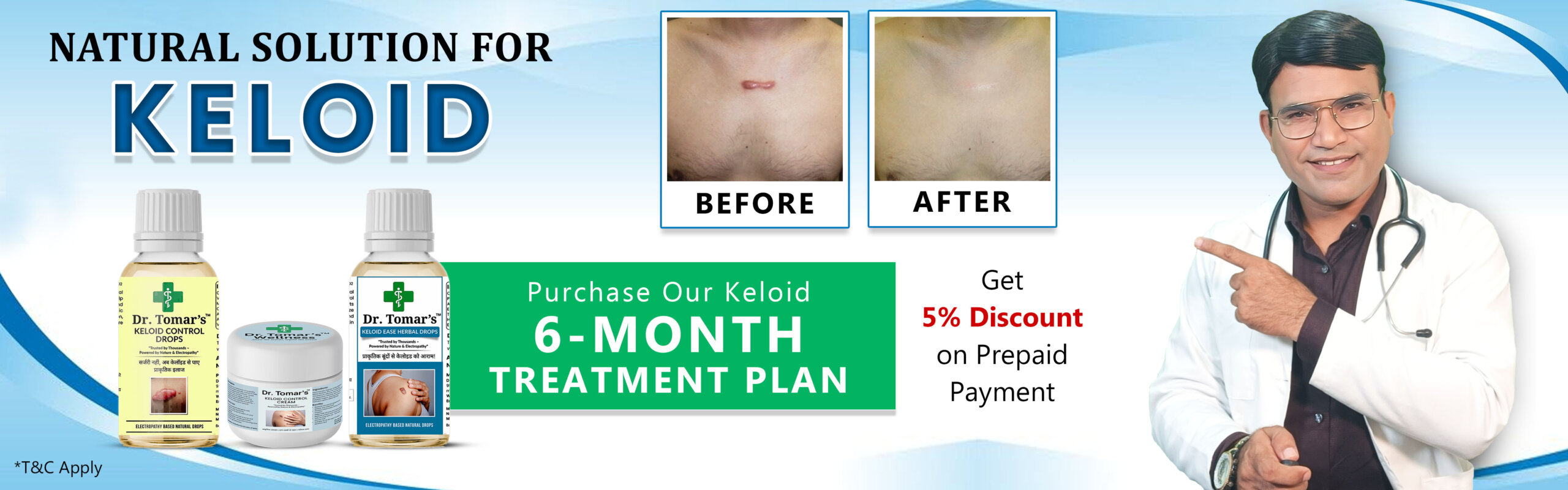 Natural Solution for Keloid Banner