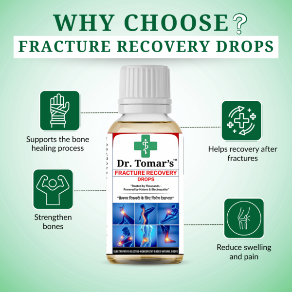 fracture