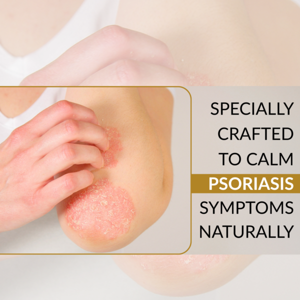 psoriasis