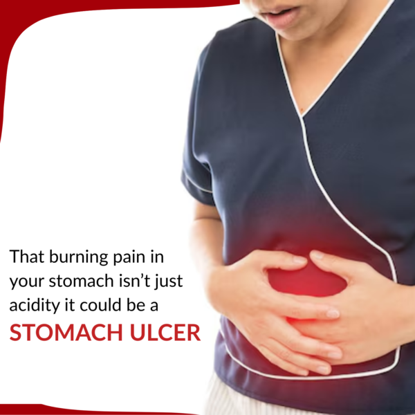 stomach ulcer