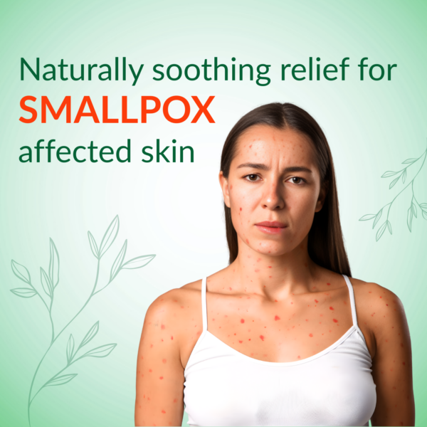 smallpox affected skin