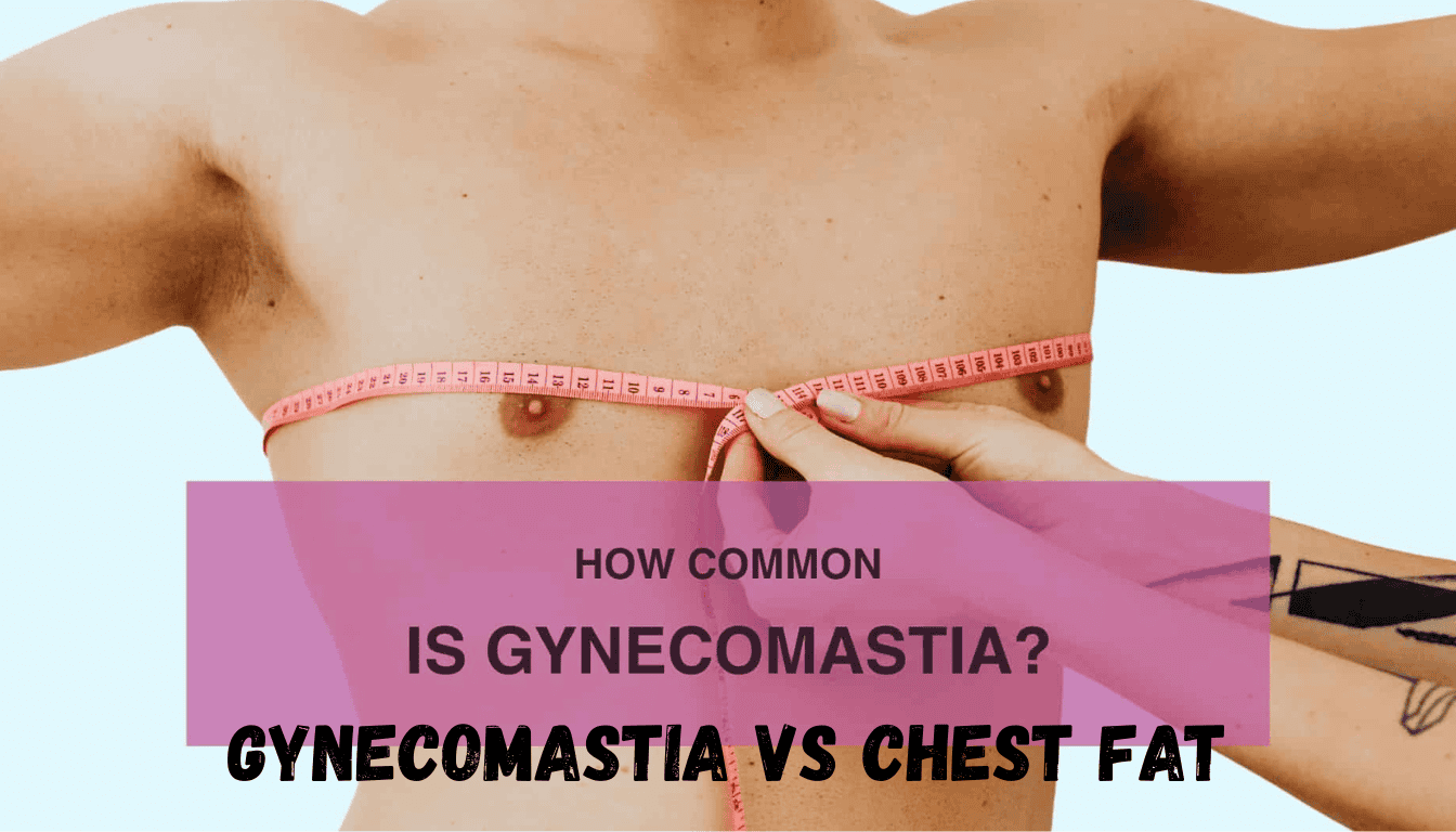 gynecomastia vs chest fat