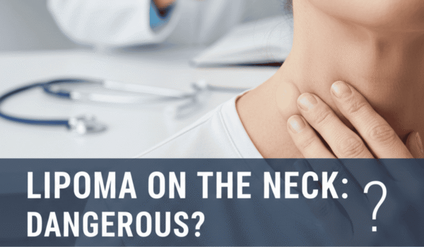 Lipoma on The Neck