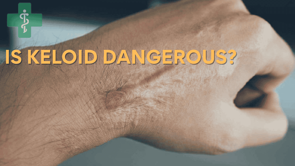 is keloid dangerous