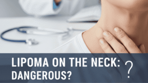 Lipoma on The Neck