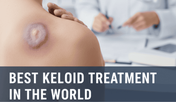 Best keloid treatment in the world