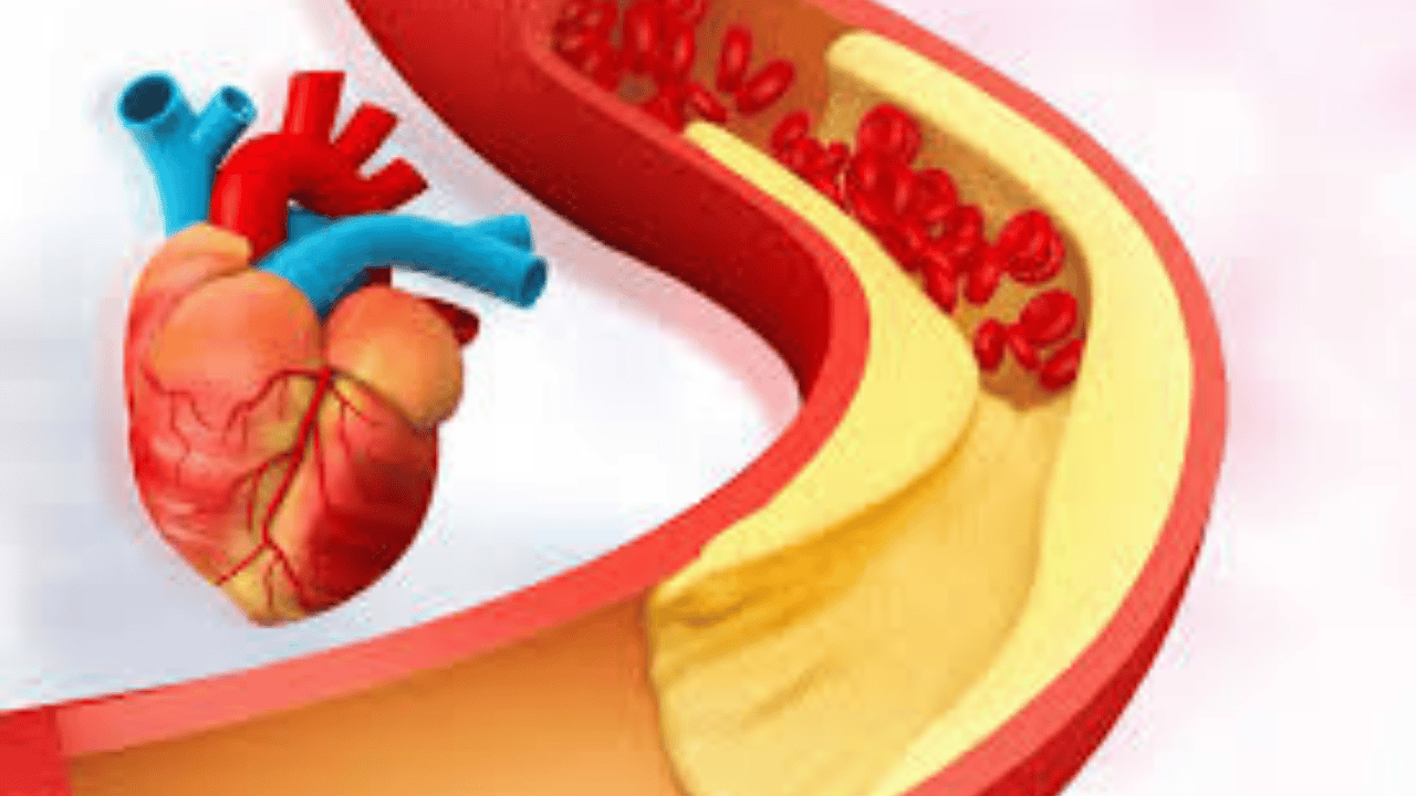 herbal cholesterol management