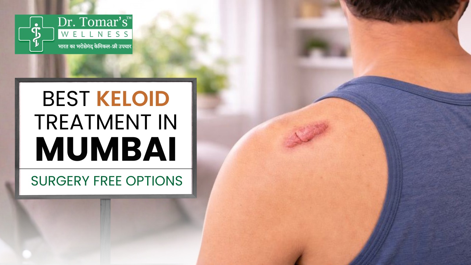 Keloid Treatment in Mumbai
