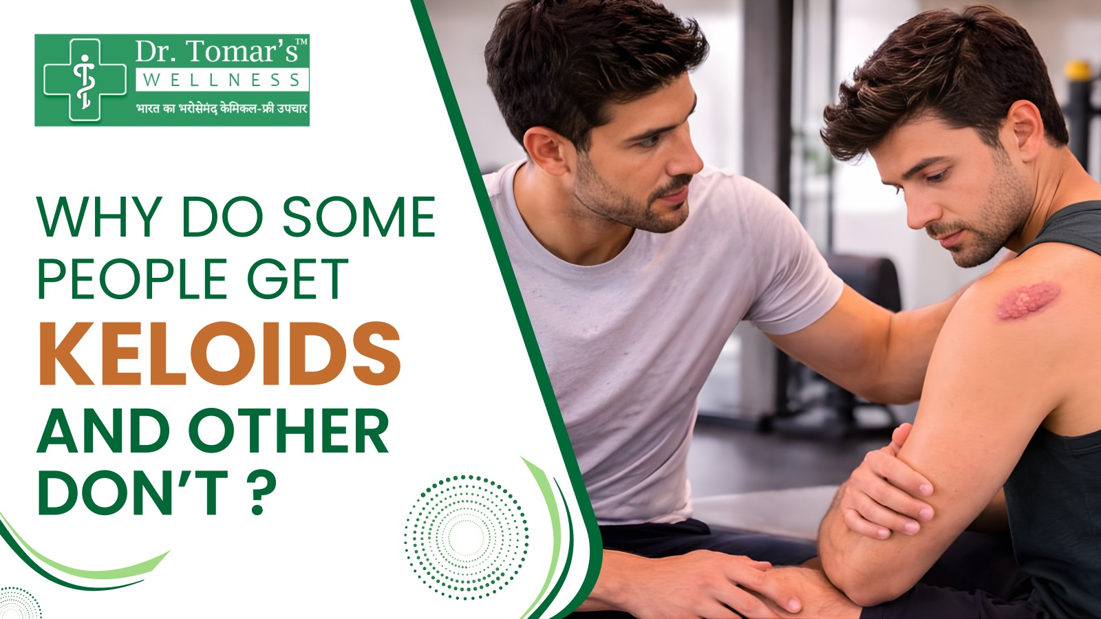 why do some people get keloids