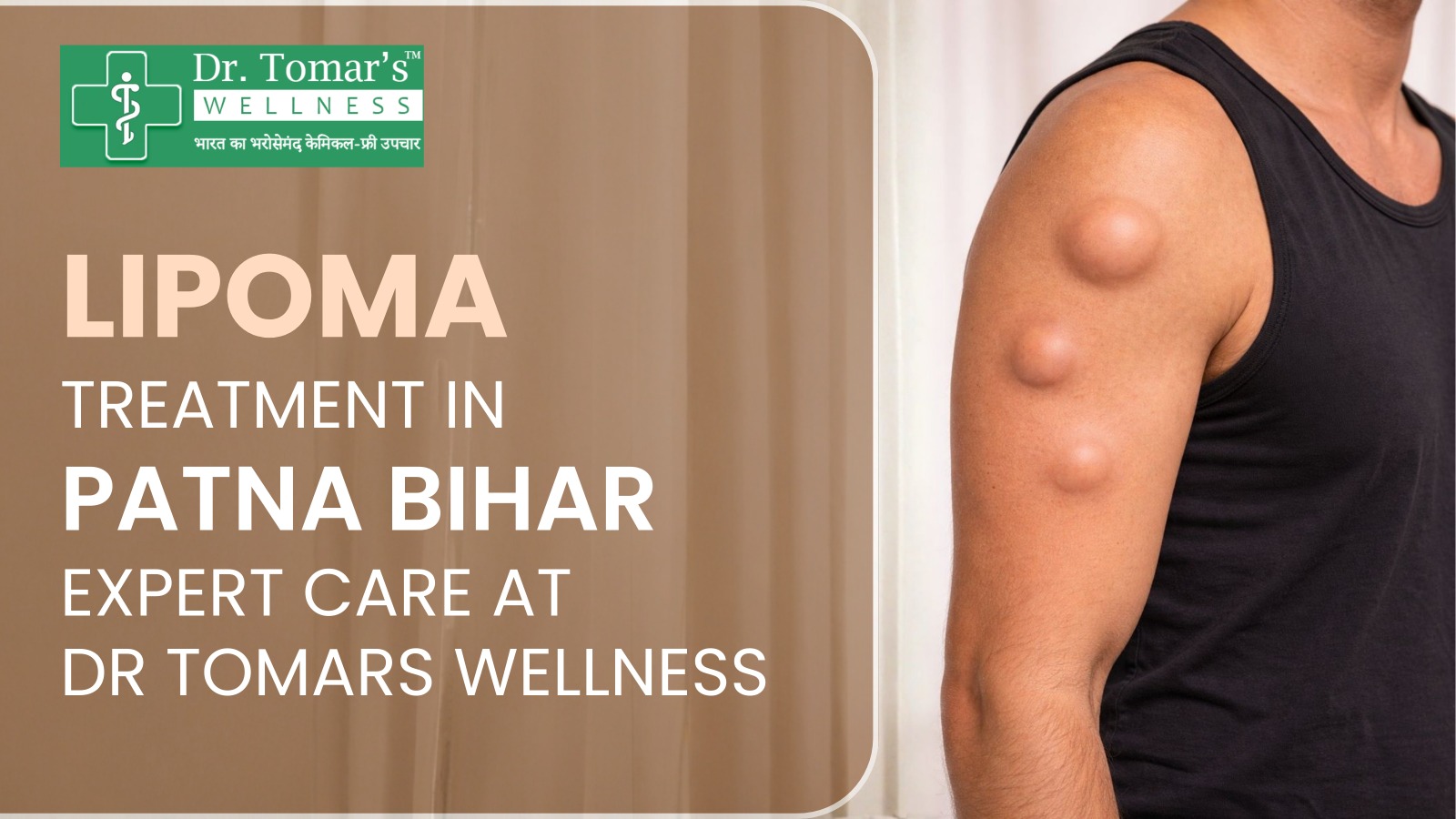 Lipoma Treatment in Patna Bihar