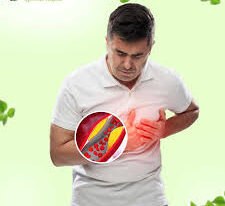 herbal cholesterol management,Cholesterol Support