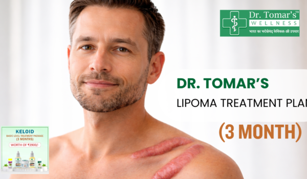 Keloid Treatment Plan