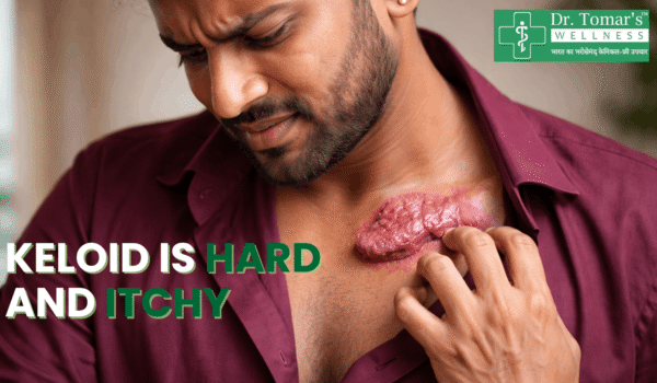 keloid is hard and itchy