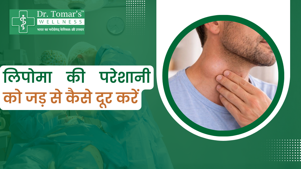 लिपोमा की परेशानी को जड़ से कैसे दूर करें