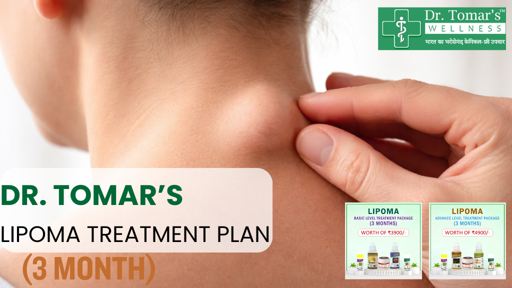 Dr. Tomar’s 3 Month Lipoma Treatment Plan – Who Is It For? 1 Lipoma Treatment Plan
