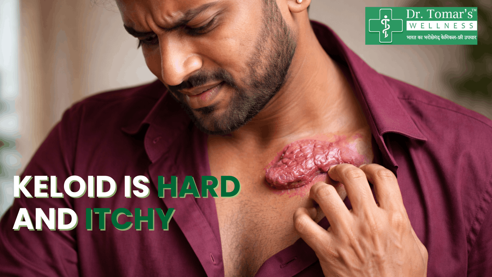 my keloid is hard and itchy what does it mean 1 keloid is hard and itchy