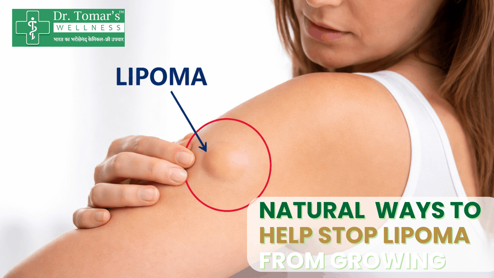 Natural Ways to Help Stop Lipoma from Growing 1 stop lipoma from growing