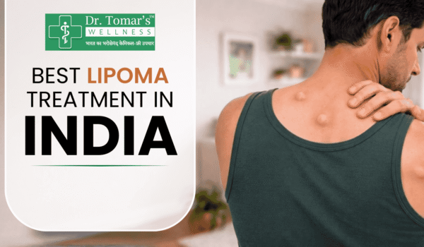 lipoma treatment in india