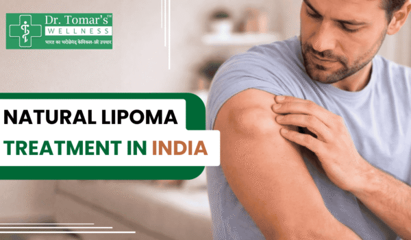 natural lipoma treatment in India