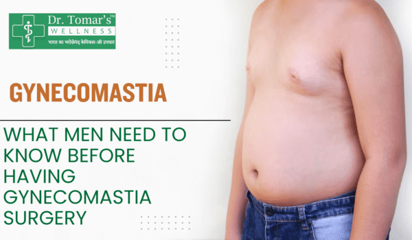 How to Treat Gynecomastia Naturally