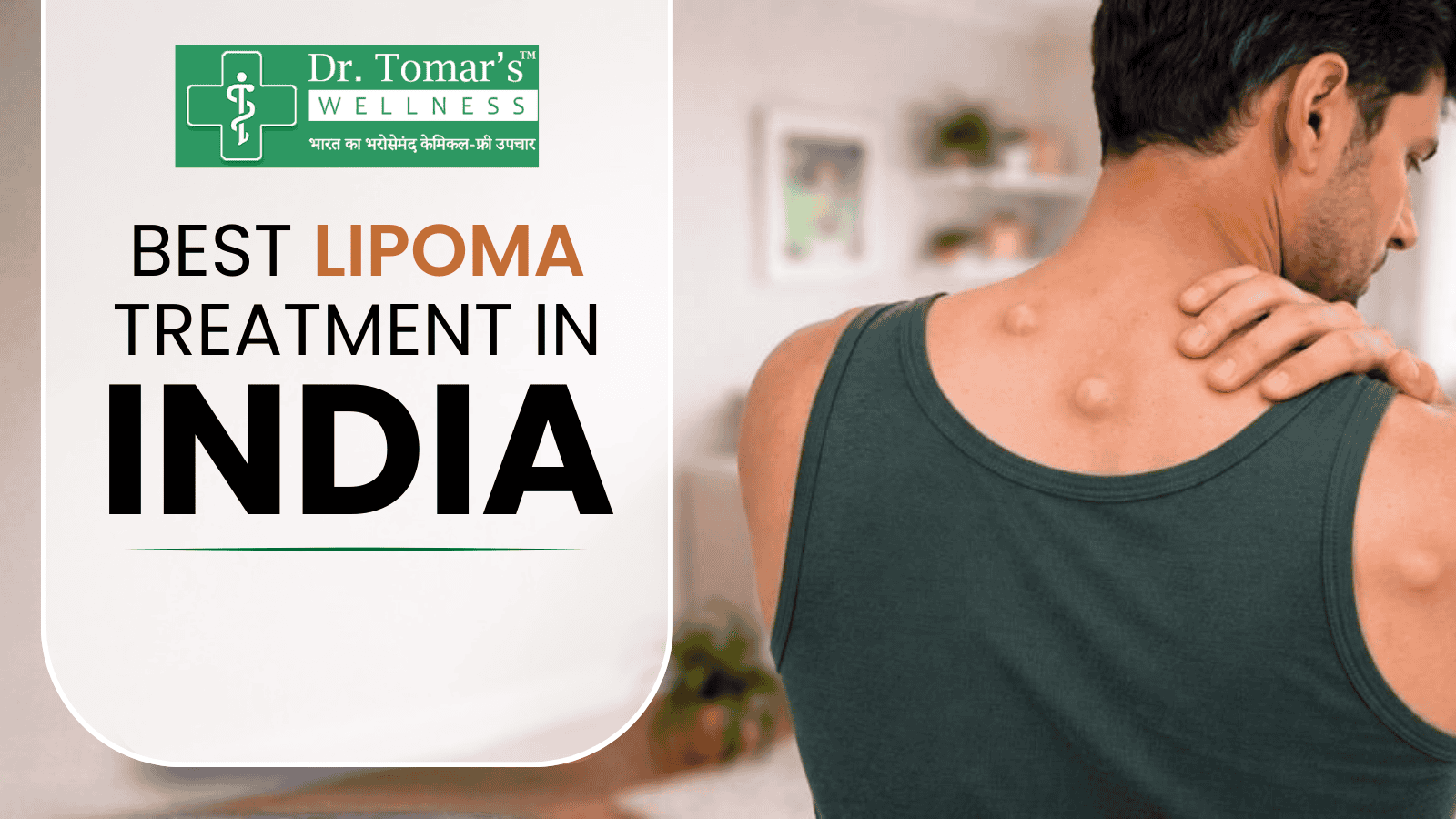 lipoma treatment in india