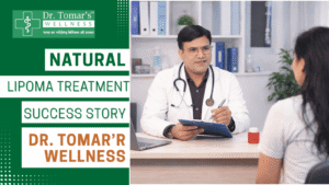 Lipoma Treatment Success Story
