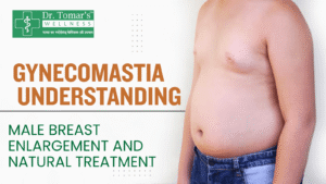 Gynecomastia Understanding