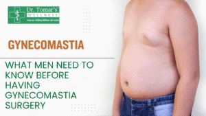 How to Treat Gynecomastia Naturally