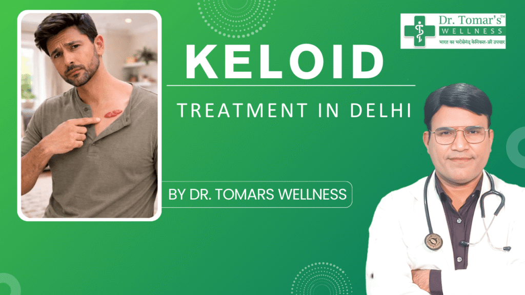KELOID TREATMENT IN DELHI