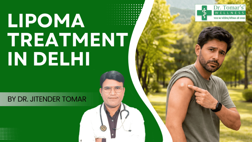 LIPOMA TREATMENT IN DELHI