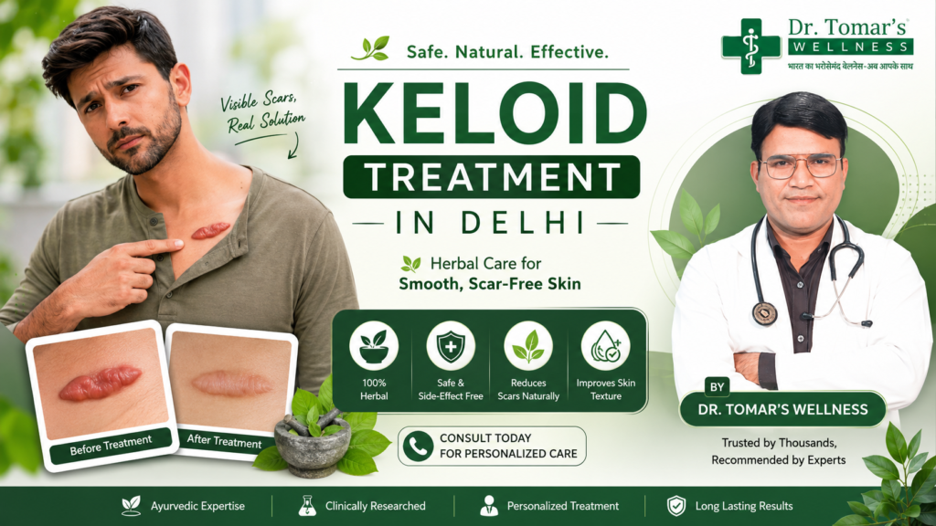 Lipoma Treatment In Delhi